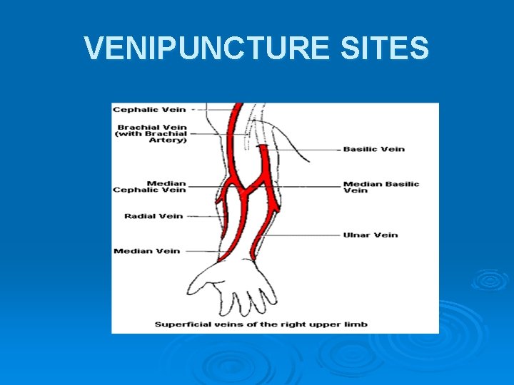 VENIPUNCTURE SITES 