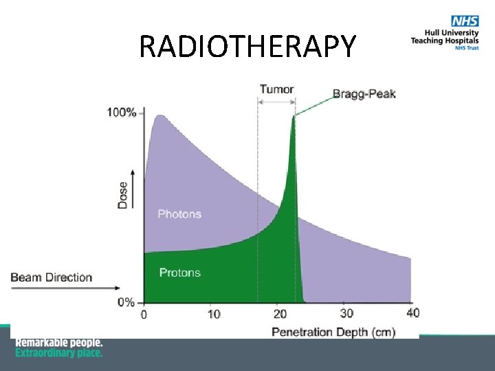 RADIOTHERAPY 