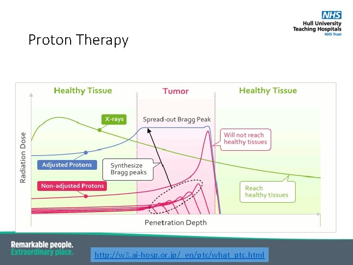 Proton Therapy http: //w 3. ai-hosp. or. jp/_en/ptc/what_ptc. html 