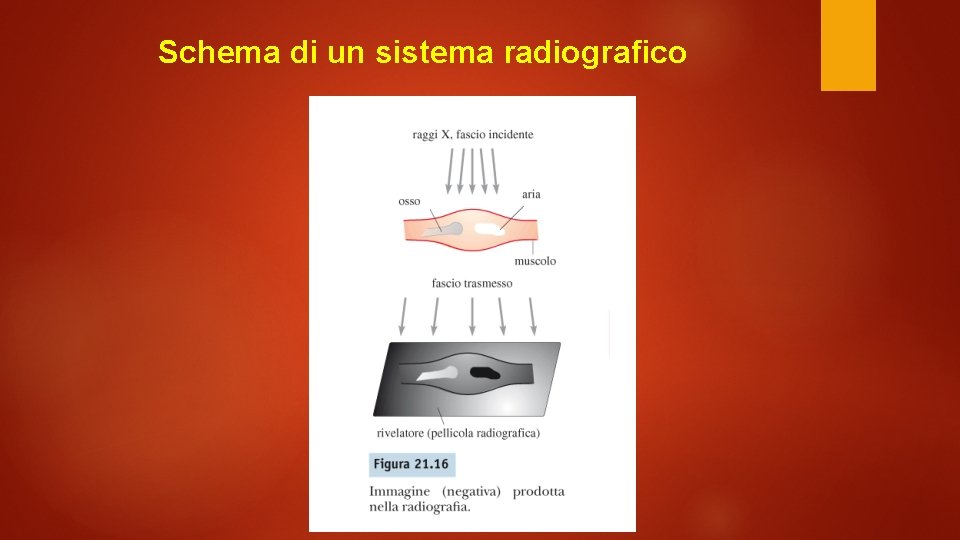 Schema di un sistema radiografico 