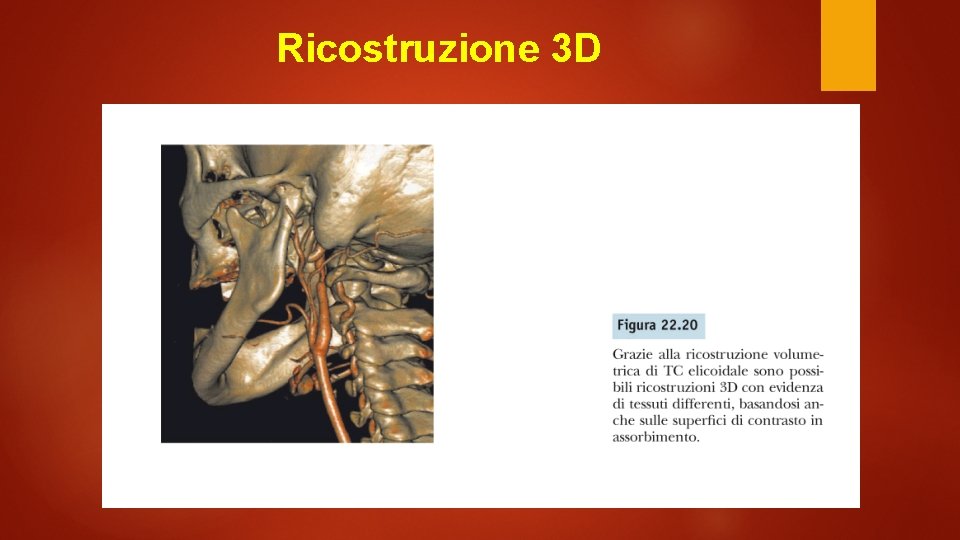 Ricostruzione 3 D 