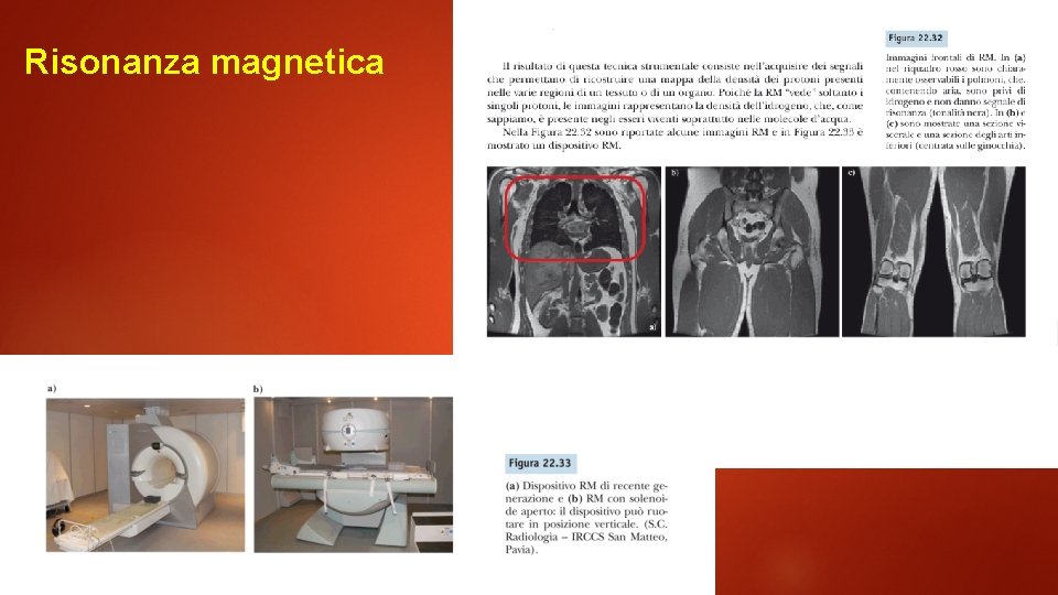 Risonanza magnetica 