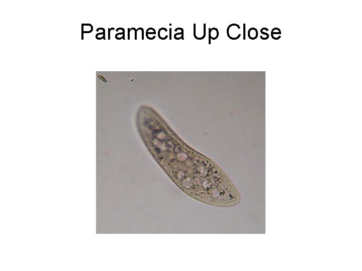 Paramecia Up Close 