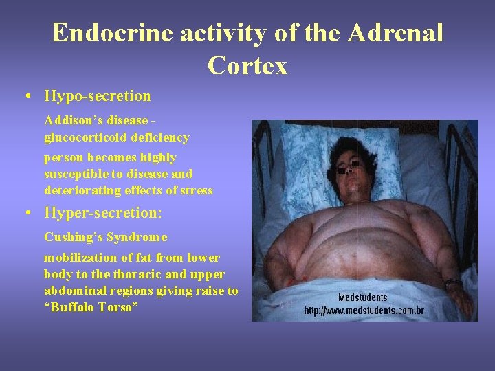 Endocrine activity of the Adrenal Cortex • Hypo-secretion Addison’s disease glucocorticoid deficiency person becomes Endocrine activity of the Adrenal Cortex • Hypo-secretion Addison’s disease glucocorticoid deficiency person becomes