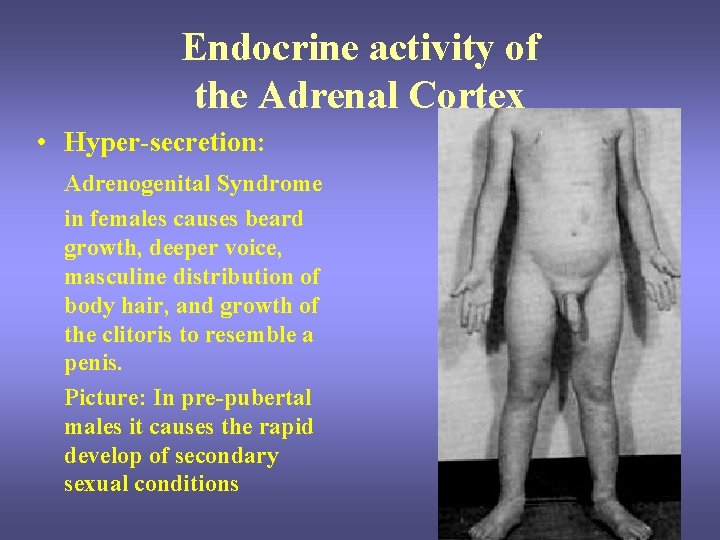 Endocrine activity of the Adrenal Cortex • Hyper-secretion: Adrenogenital Syndrome in females causes beard Endocrine activity of the Adrenal Cortex • Hyper-secretion: Adrenogenital Syndrome in females causes beard