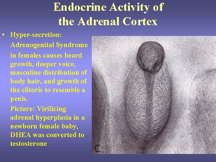 Endocrine Activity of the Adrenal Cortex • Hyper-secretion: Adrenogenital Syndrome in females causes beard Endocrine Activity of the Adrenal Cortex • Hyper-secretion: Adrenogenital Syndrome in females causes beard