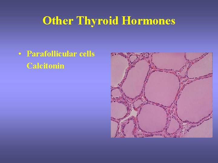 Other Thyroid Hormones • Parafollicular cells Calcitonin Other Thyroid Hormones • Parafollicular cells Calcitonin