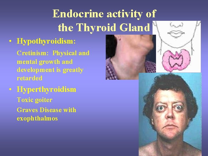 Endocrine activity of the Thyroid Gland • Hypothyroidism: Cretinism: Physical and mental growth and Endocrine activity of the Thyroid Gland • Hypothyroidism: Cretinism: Physical and mental growth and