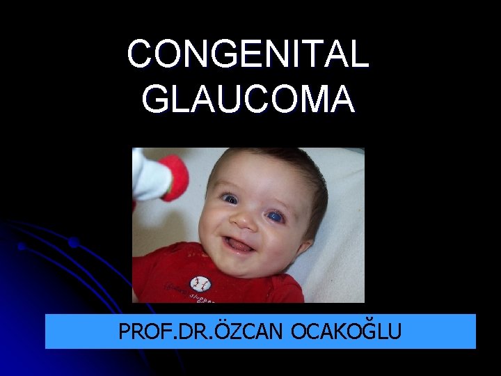 CONGENITAL GLAUCOMA PROF. DR. ÖZCAN OCAKOĞLU 