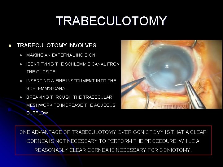 TRABECULOTOMY l TRABECULOTOMY INVOLVES l MAKING AN EXTERNAL INCISION l IDENTIFYING THE SCHLEMM’S CANAL
