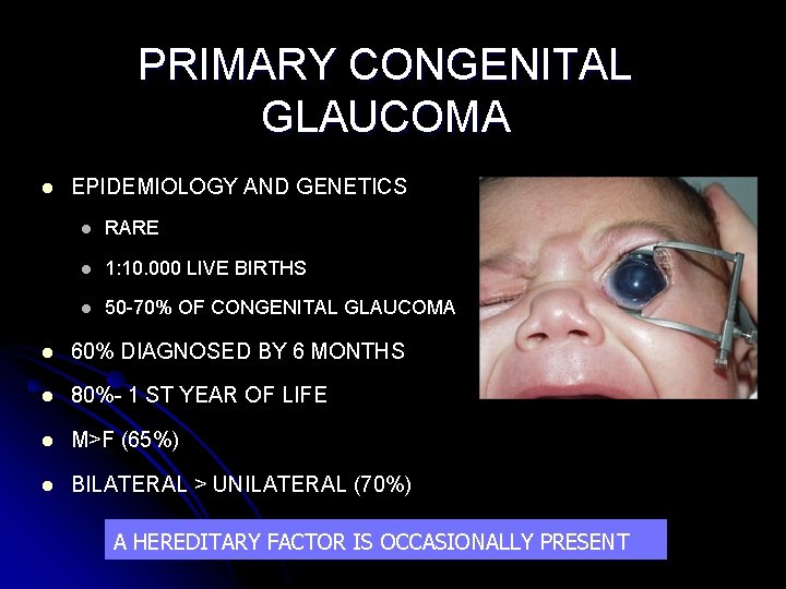PRIMARY CONGENITAL GLAUCOMA l EPIDEMIOLOGY AND GENETICS l RARE l 1: 10. 000 LIVE
