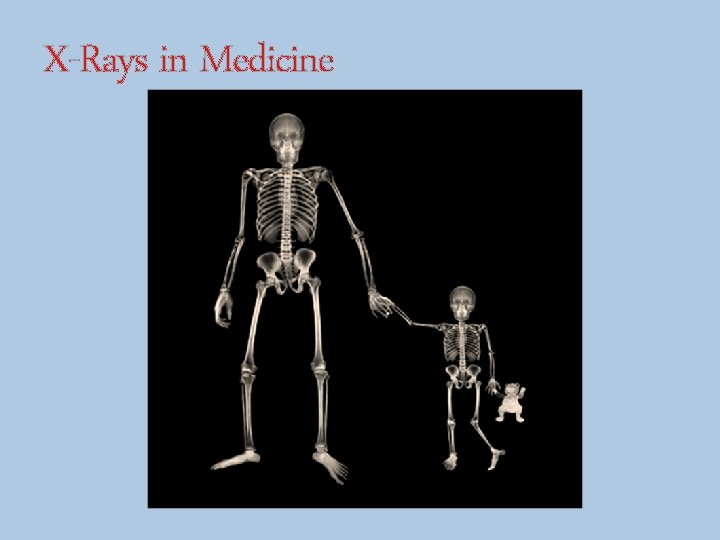 X-Rays in Medicine 