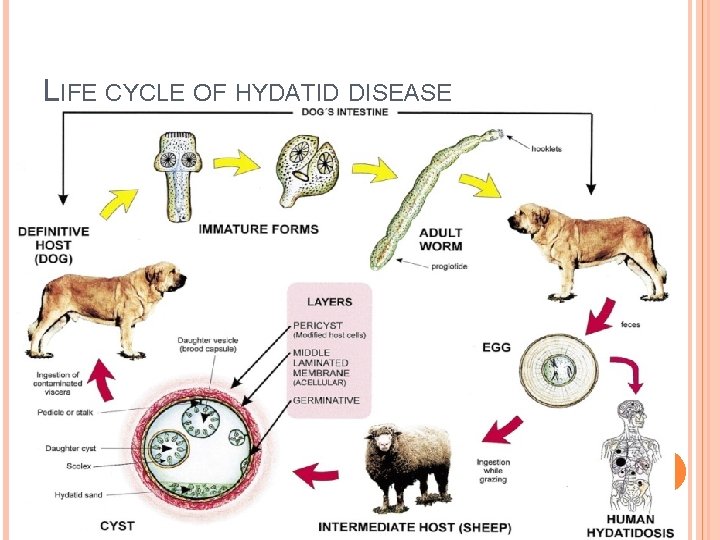 LIFE CYCLE OF HYDATID DISEASE 