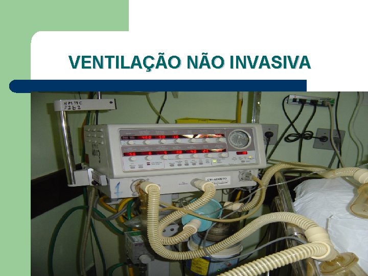 VENTILAÇÃO NÃO INVASIVA 