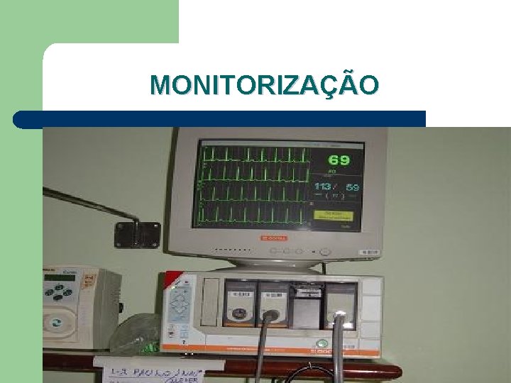 MONITORIZAÇÃO 