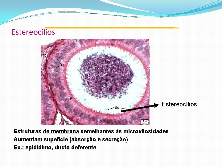 Estereocílios Estruturas de membrana semelhantes às microvilosidades Aumentam supefície (absorção e secreção) Ex. :