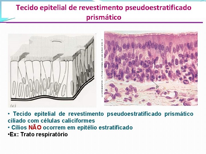 Tecido epitelial de revestimento pseudoestratificado prismático • Tecido epitelial de revestimento pseudoestratificado prismático ciliado