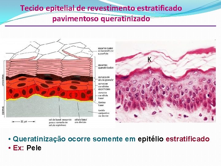 Tecido epitelial de revestimento estratificado pavimentoso queratinizado • Queratinização ocorre somente em epitélio estratificado