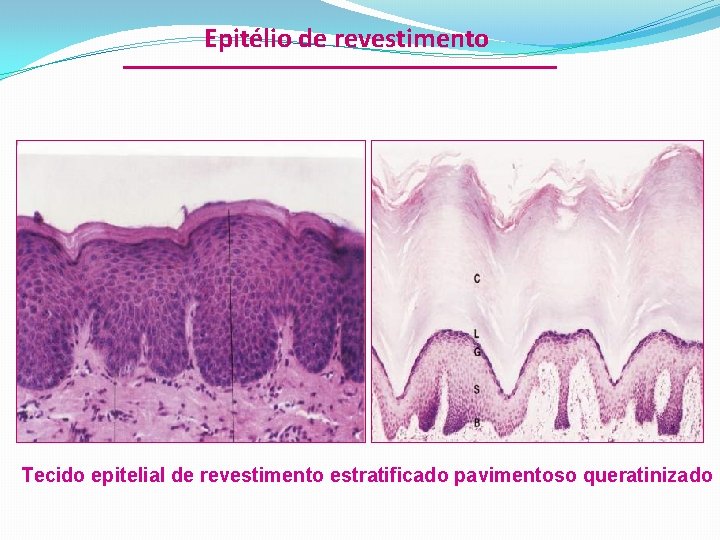 Epitélio de revestimento Tecido epitelial de revestimento estratificado pavimentoso queratinizado 