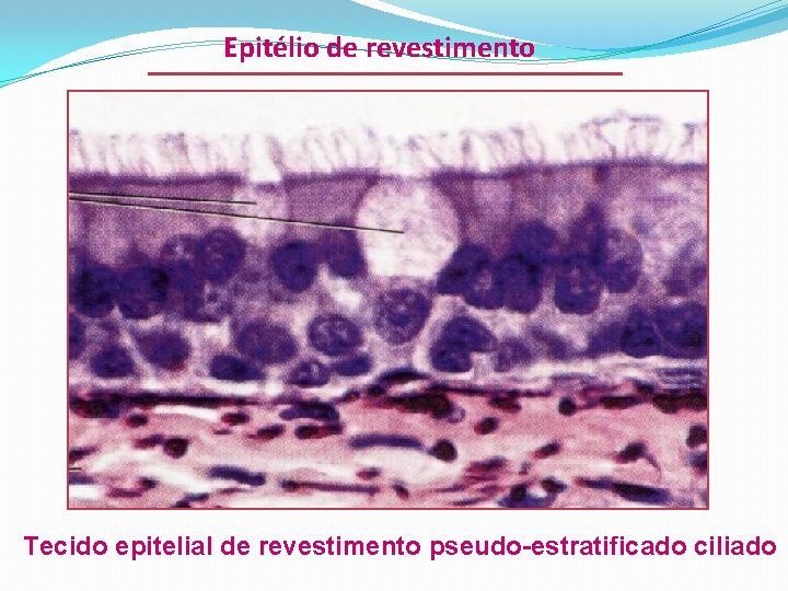 Epitélio de revestimento Tecido epitelial de revestimento pseudo-estratificado ciliado 