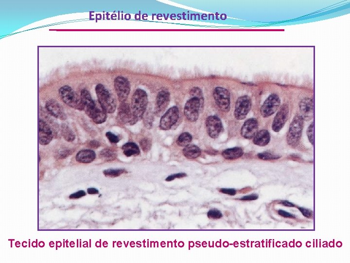 Epitélio de revestimento Tecido epitelial de revestimento pseudo-estratificado ciliado 