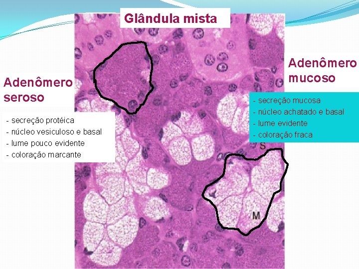 Glândula mista Adenômero seroso - secreção protéica - núcleo vesiculoso e basal - lume