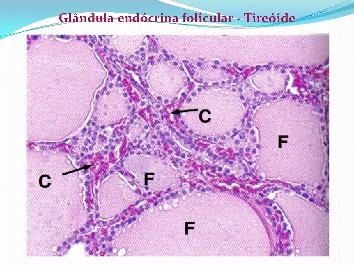 Glândula endócrina folicular - Tireóide 