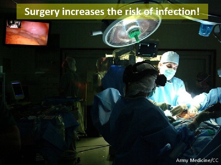 Surgery increases the risk of infection! Army Medicine/CC 