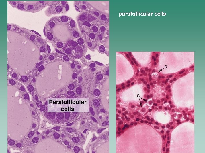 parafollicular cells 