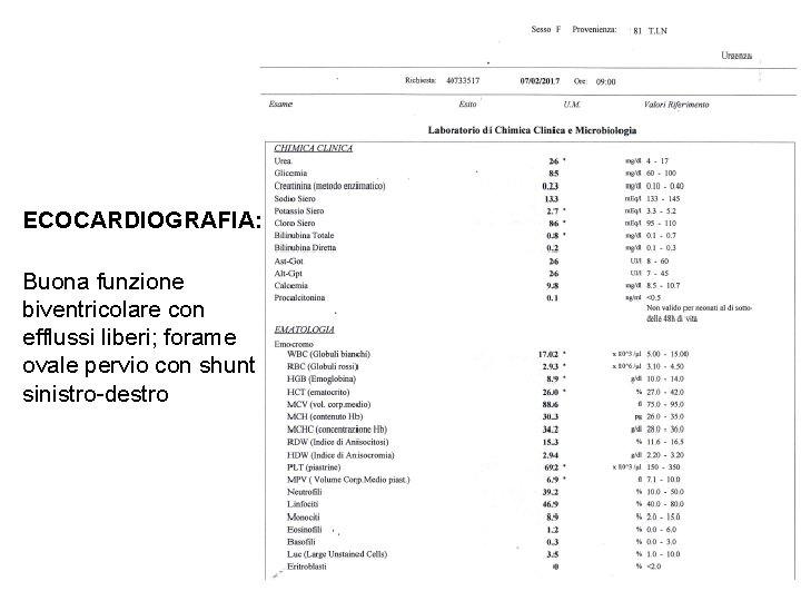 ECOCARDIOGRAFIA: Buona funzione biventricolare con efflussi liberi; forame ovale pervio con shunt sinistro-destro 