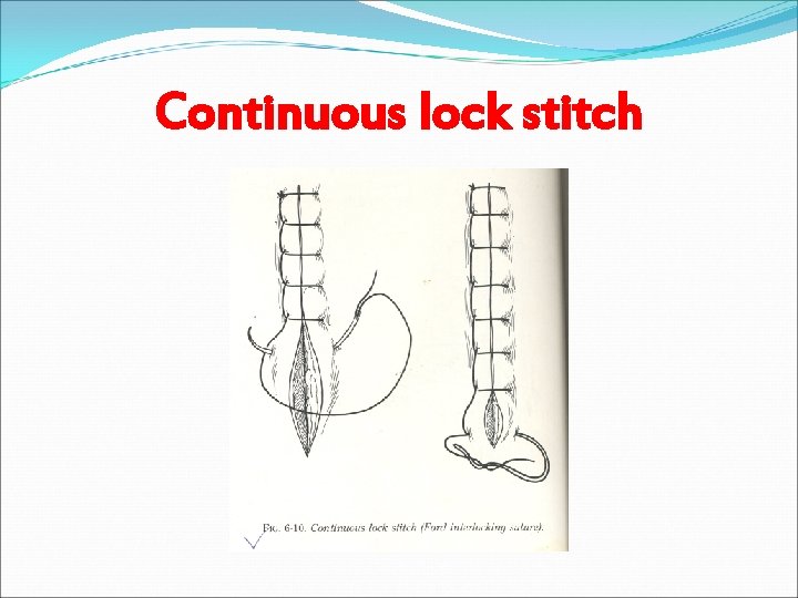 Continuous lock stitch 