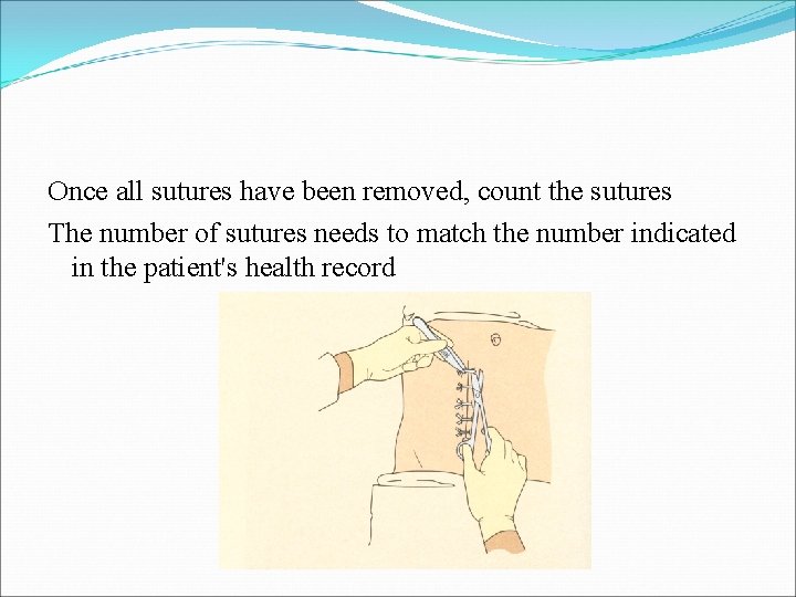 Once all sutures have been removed, count the sutures The number of sutures needs