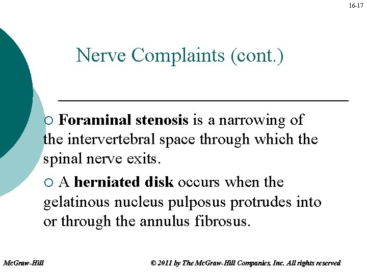 16 -17 Nerve Complaints (cont. ) Foraminal stenosis is a narrowing of the intervertebral