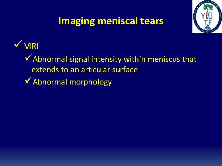 Imaging meniscal tears üMRI üAbnormal signal intensity within meniscus that extends to an articular