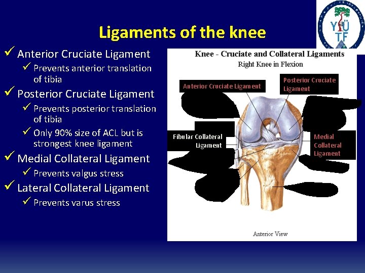 Ligaments of the knee ü Anterior Cruciate Ligament ü Prevents anterior translation of tibia