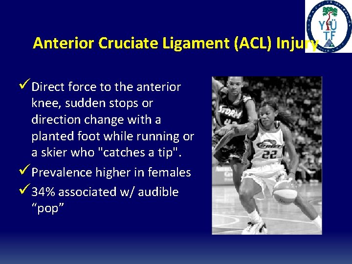 Anterior Cruciate Ligament (ACL) Injury üDirect force to the anterior knee, sudden stops or