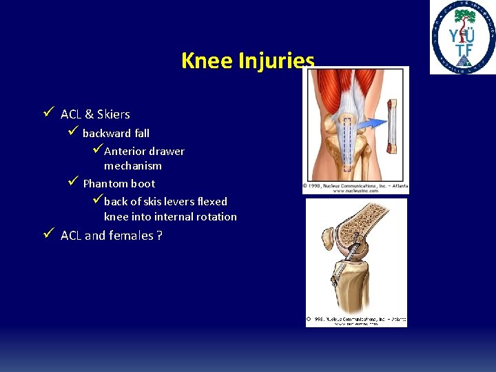 Knee Injuries ü ACL & Skiers ü backward fall üAnterior drawer mechanism ü Phantom