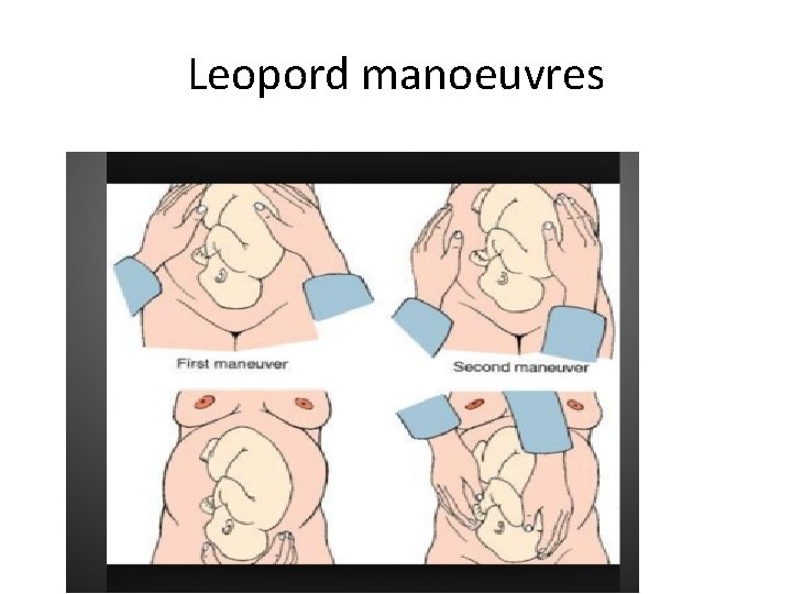 Leopord manoeuvres 
