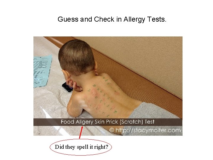 Guess and Check in Allergy Tests. Did they spell it right? 