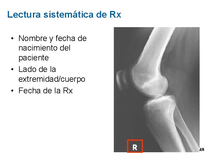 Lectura sistemática de Rx • Nombre y fecha de nacimiento del paciente • Lado