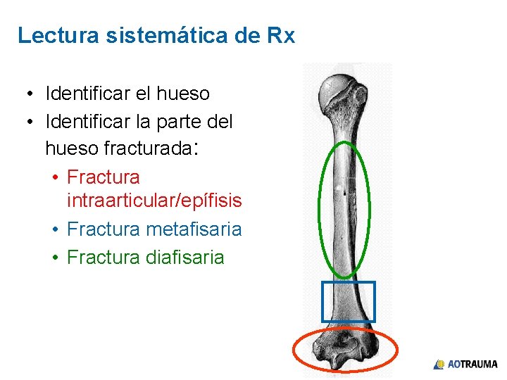 Lectura sistemática de Rx • Identificar el hueso • Identificar la parte del hueso