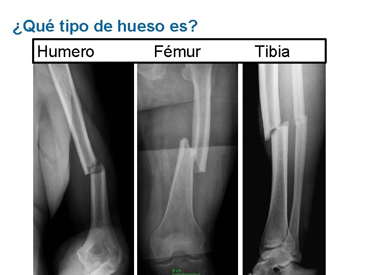 ¿Qué tipo de hueso es? Humero Fémur Tibia 