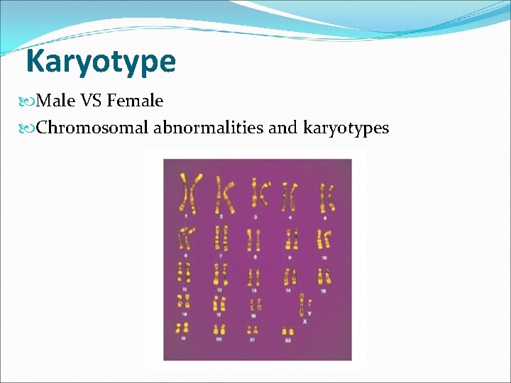 Karyotype Male VS Female Chromosomal abnormalities and karyotypes 