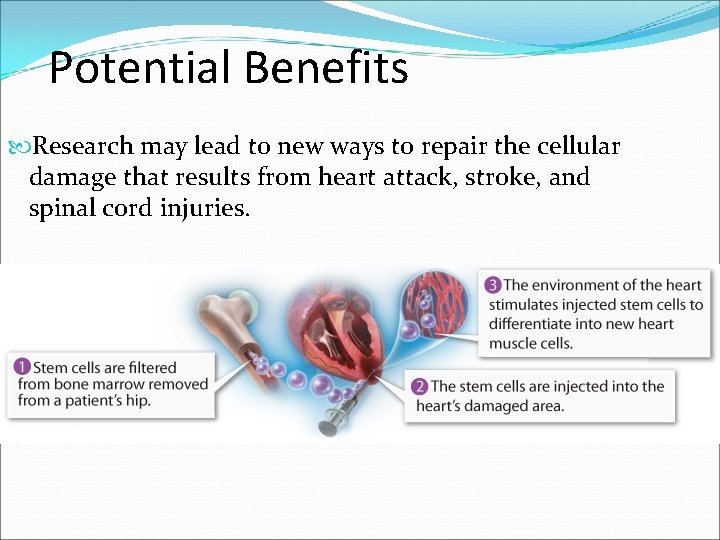 Potential Benefits Research may lead to new ways to repair the cellular damage that