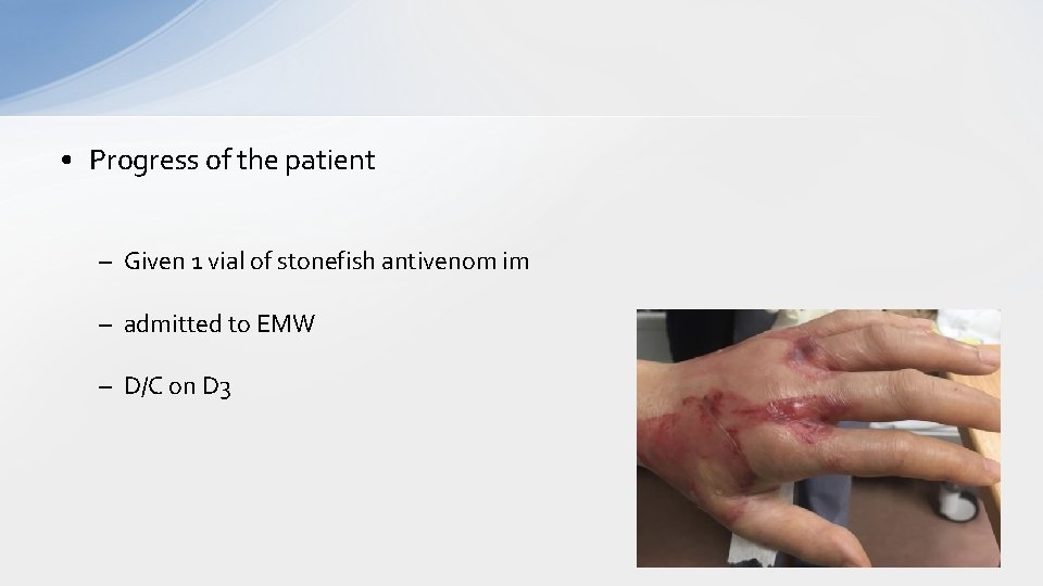  • Progress of the patient – Given 1 vial of stonefish antivenom im