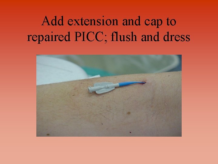 Add extension and cap to repaired PICC; flush and dress 