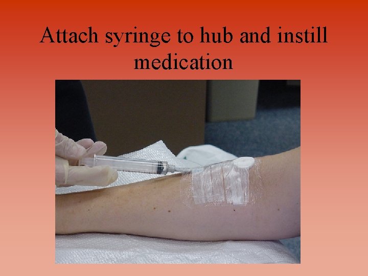 Attach syringe to hub and instill medication 