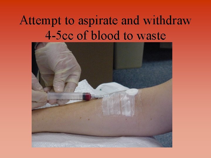 Attempt to aspirate and withdraw 4 -5 cc of blood to waste 