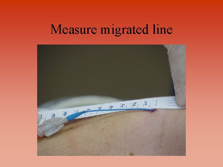 Measure migrated line 