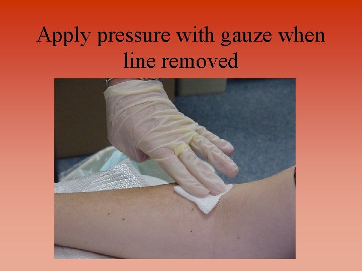 Apply pressure with gauze when line removed 